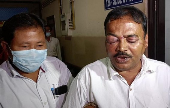 Cost of being Opposition Candidate in Tripura Municipal Poll : Ward No-51 Candidate’s one eye ‘Permanently Damaged’ after BJP goons led Barbaric Attack on Poll Day